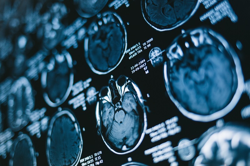 Figure 4. MRI scans rely on a careful calibration of magnitude and phase to produce high-quality diagnostic and patient results.