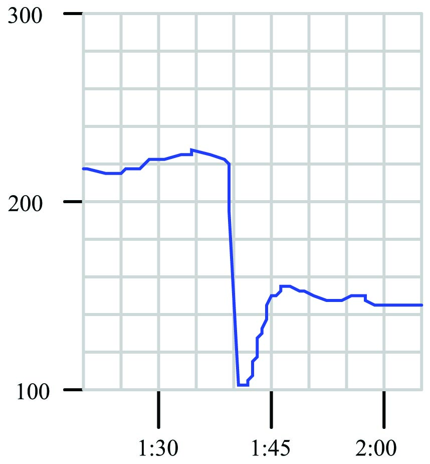 The computer would tabulate the pressure data over time