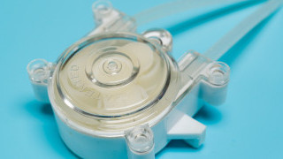 Understanding Peristaltic Pumps